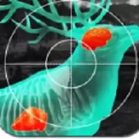 我的枪贼准最新版