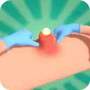 挤痘痘达人游戏