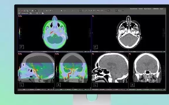 苹果Studio Display XDR功能已获FDA批准用于诊断放射学领域
